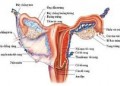 Dấu hiệu ung thư cổ tử cung ở từng giai đoạn