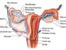 Dấu hiệu ung thư cổ tử cung ở từng giai đoạn